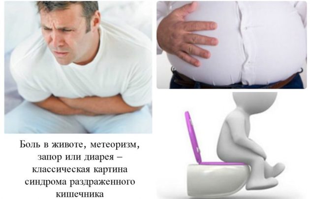 Диарея