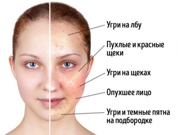 Пиво поможет избавиться от таких болезней лица