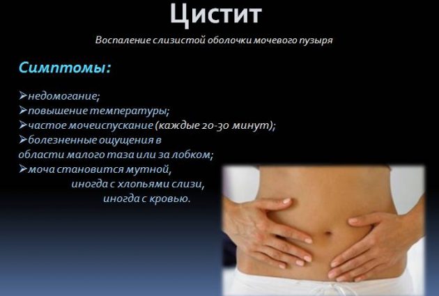 Симптомы